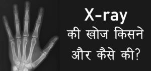 X-Ray की खोज किसने की ?